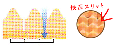 快圧スリット